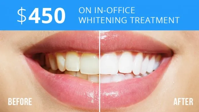 32916 in office whitening