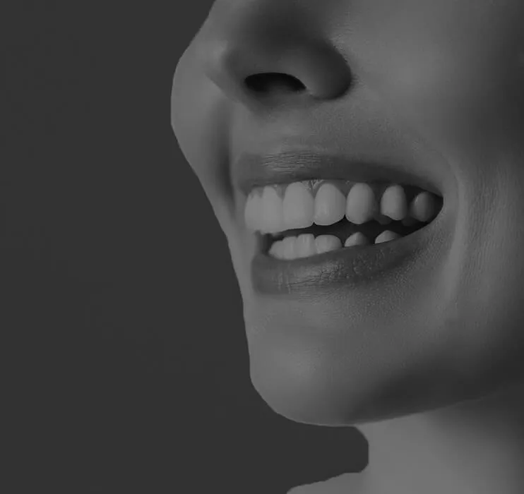 32918 at home teeth whitening kit