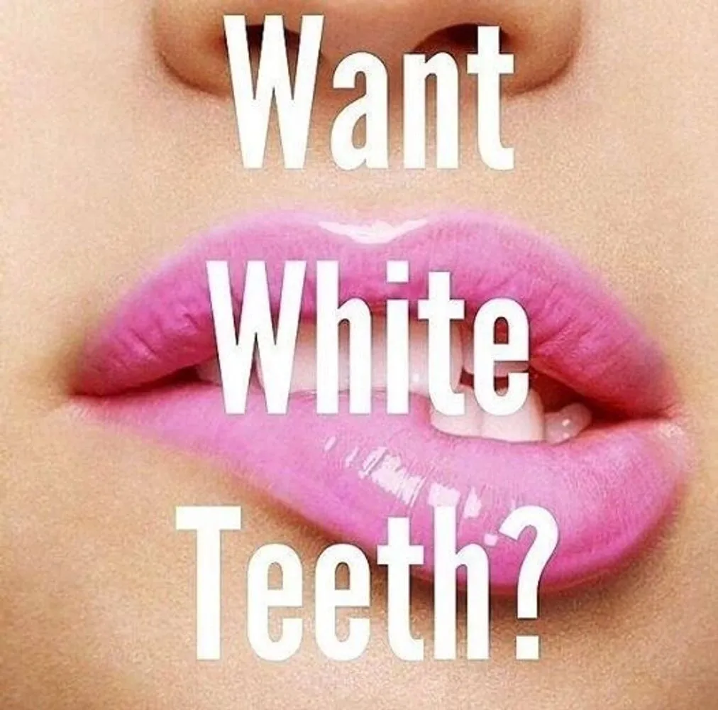 32926 professional teeth whitening