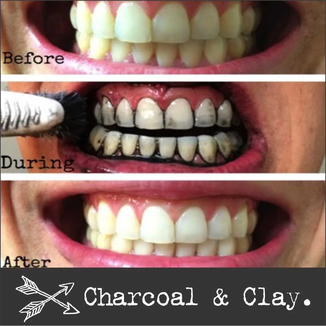 32929 charcoal teeth whitening application