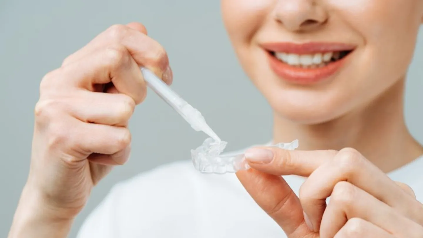 32936 at home whitening kits