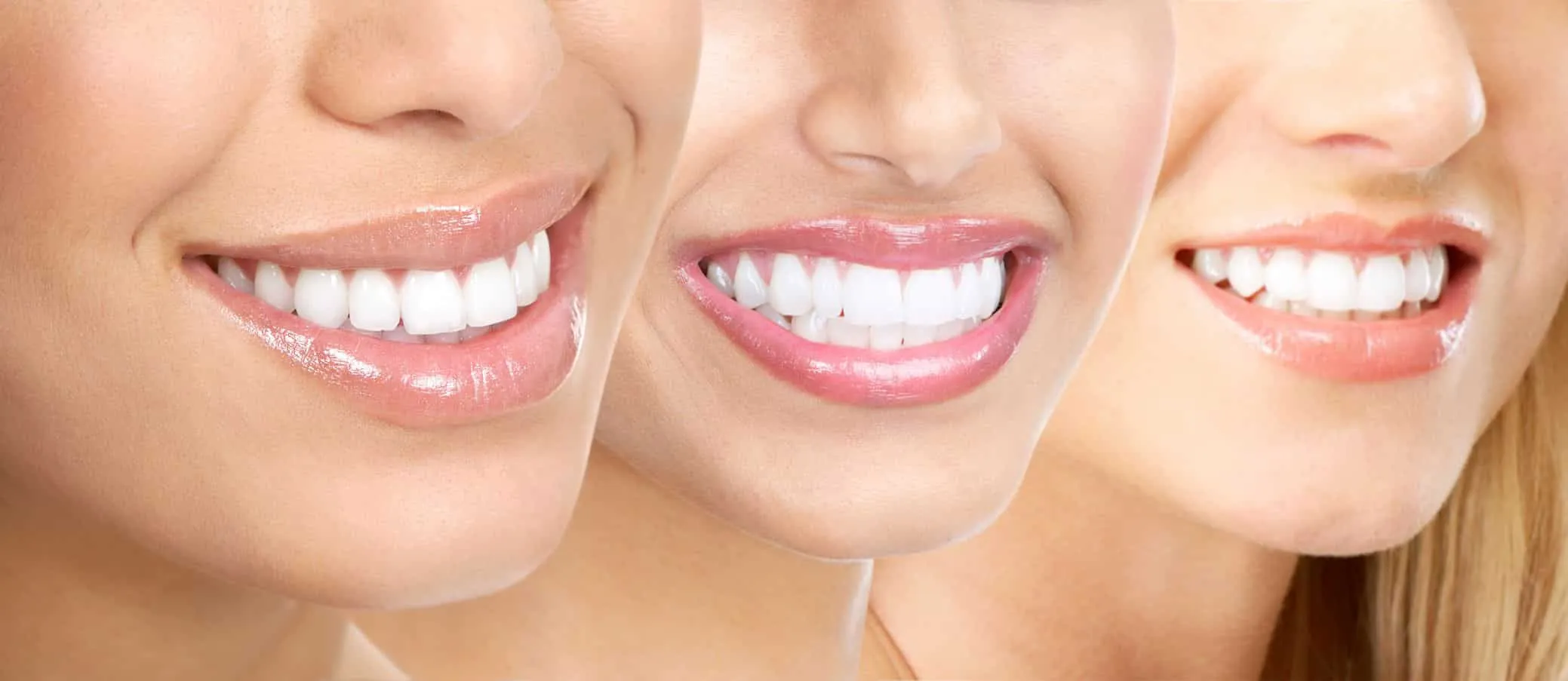 32937 teeth whitening idaho falls 1