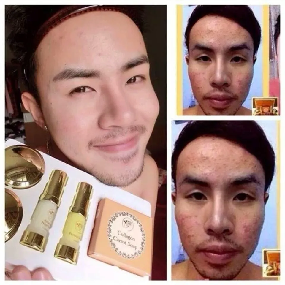 32947 thailand whitening dentist