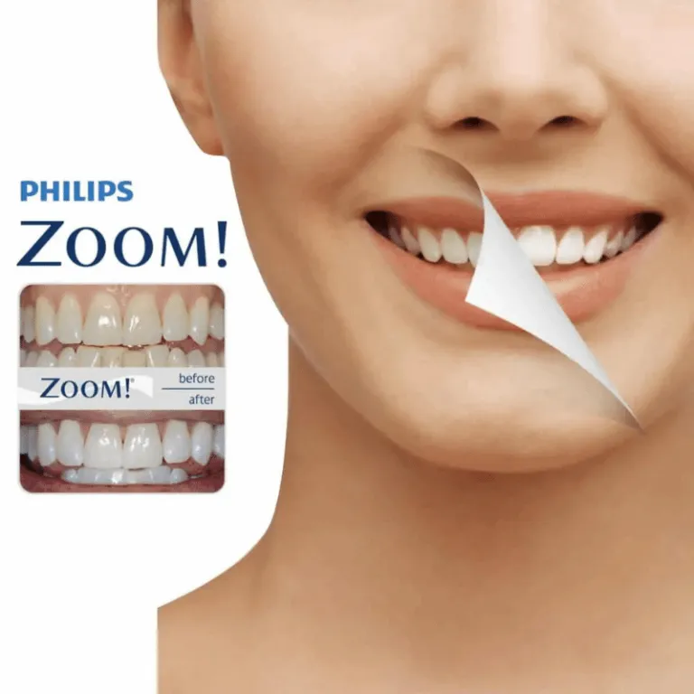 32948 philips zoom gel application