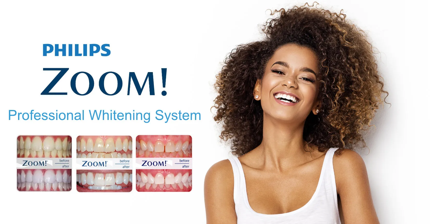 32955 teeth whitening options