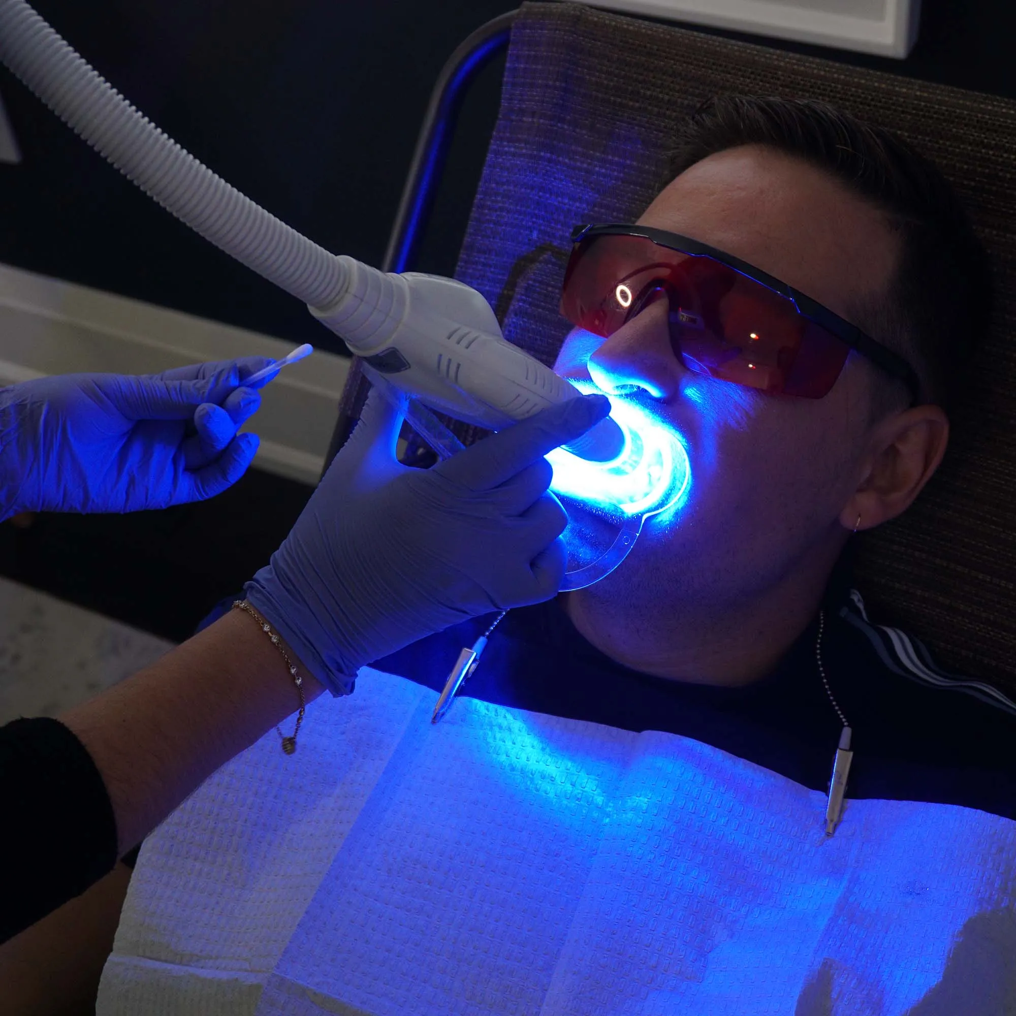 32957 teeth whitening college station image5