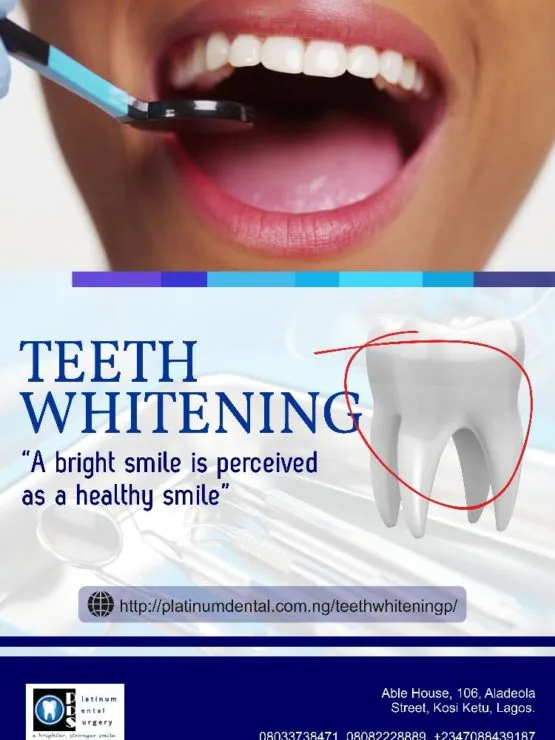32960 laser teeth whitening procedure