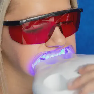 /img/32967-teeth-whitening-maintenance.webp