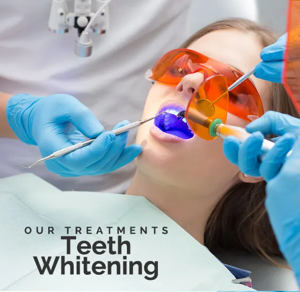 32976 at home whitening kits
