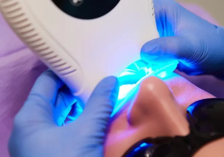 32979 cracked teeth whitening
