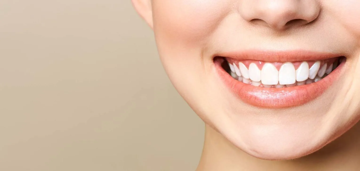 32980 teeth whitening before and after