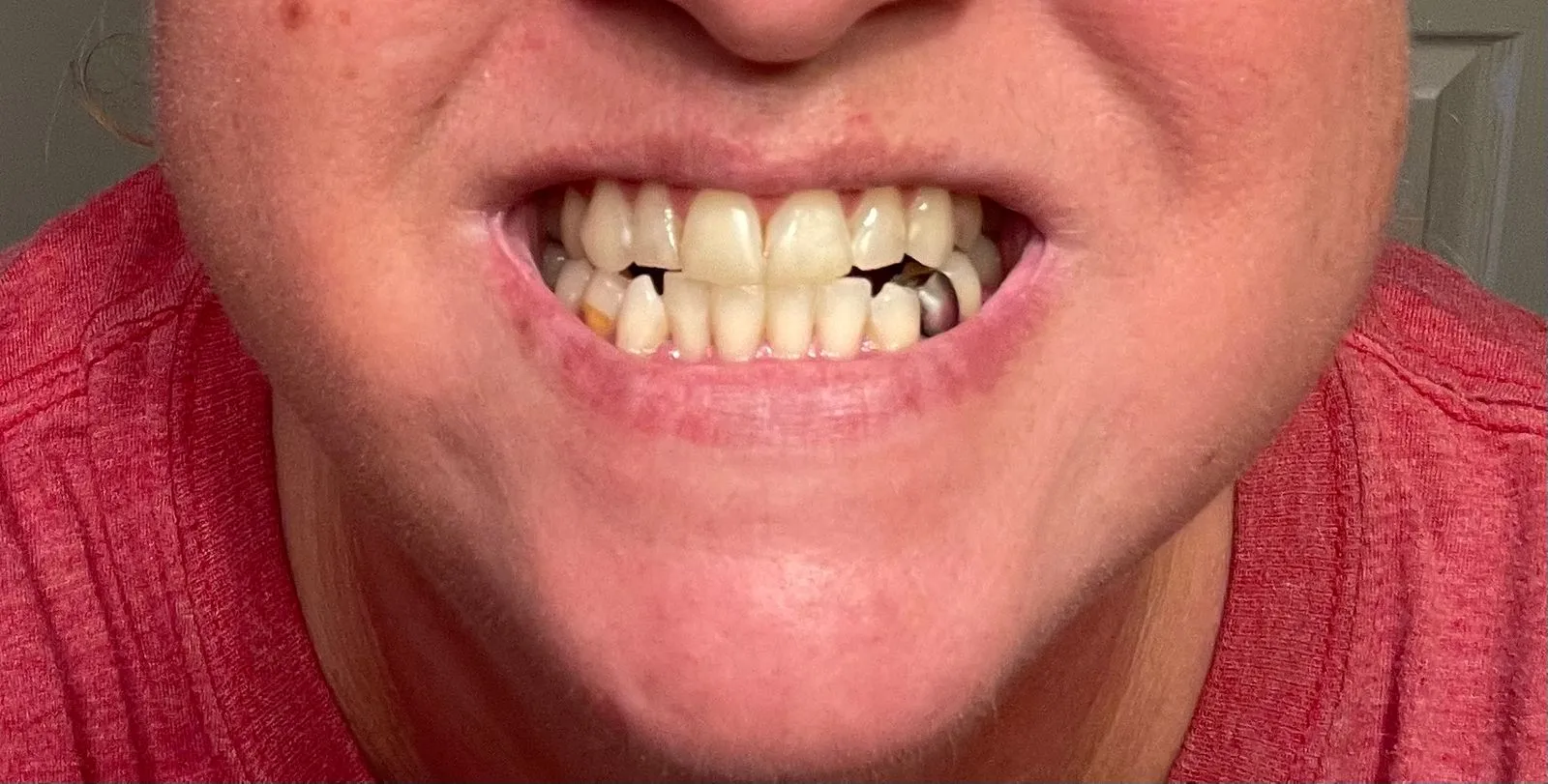 32984 whitening powder results