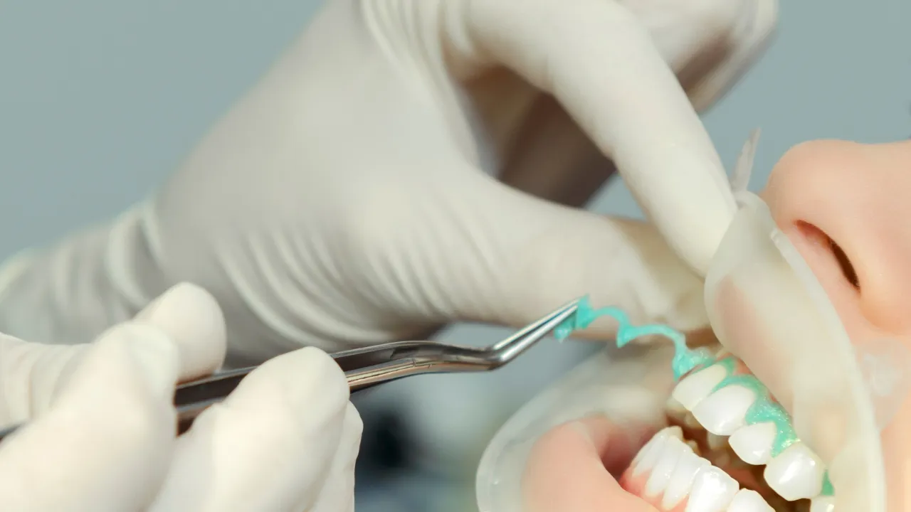 32985 breastfeeding teeth whitening safe