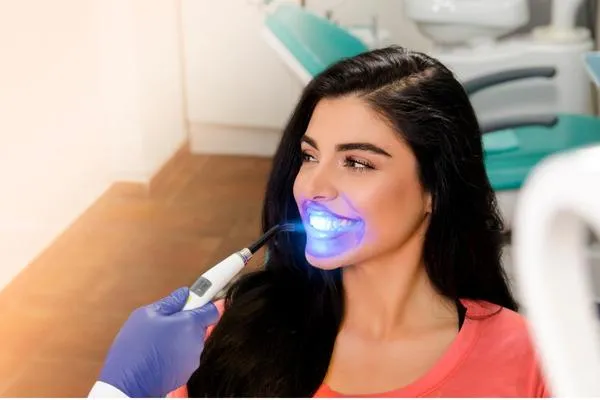 32985 professional teeth whitening