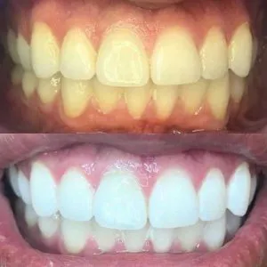 32989 bethesda dentist teeth whitening