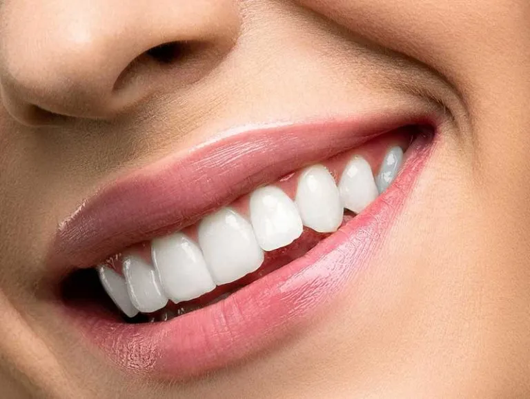 32989 teeth whitening bethesda before after