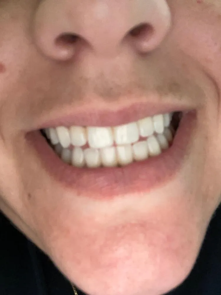 32990 healthy diet teeth whitening