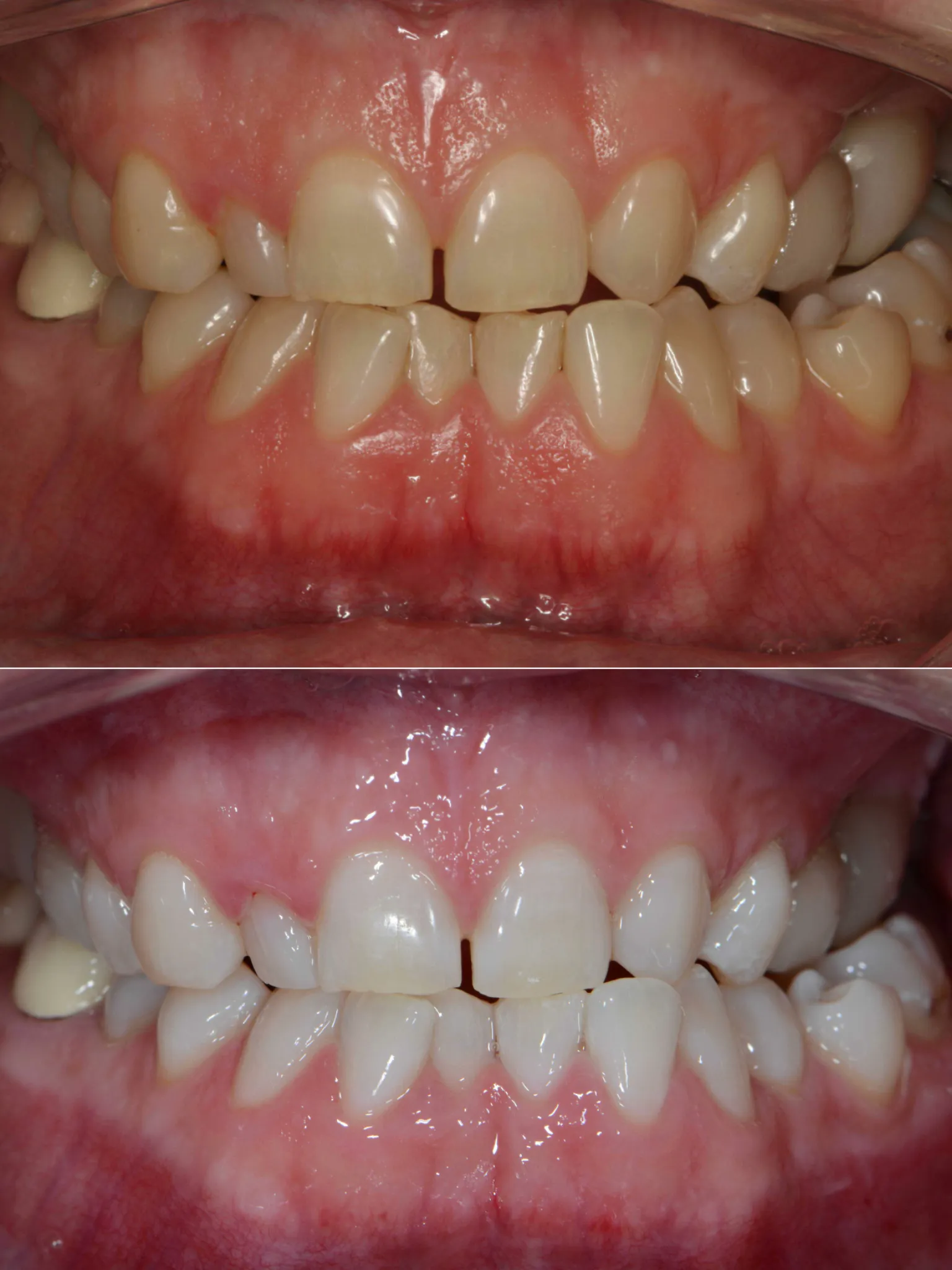 32996 red wine stain